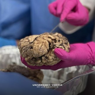 #rapacesenacción 🧠🦅

Rapaces de Psicología realizaron la disección del cerebro 🧠 práctica clave para conocer su estructura y funcionamiento dentro de su formación profesional 👩‍⚕️👨‍⚕️

📍Campus Cd. Victoria