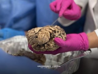 #rapacesenacción 🧠🦅

Rapaces de Psicología realizaron la disección del cerebro 🧠 práctica clave para conocer su estructura y funcionamiento dentro de su formación profesional 👩‍⚕️👨‍⚕️

📍Campus Cd. Victoria